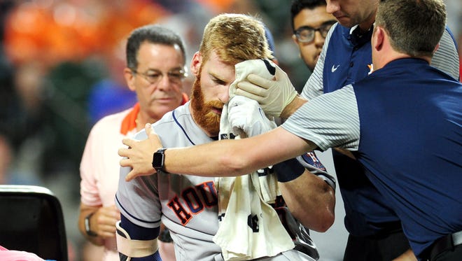 Colin Moran leaves the field with a bloody cut under his left eye.